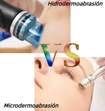 ¿Microdermoabrasión o Hidrodermoabrasión? Descubre Cuál es Mejor Para Ti